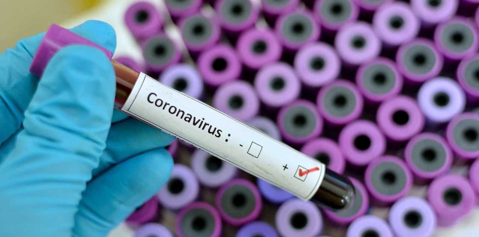 Coronavirus: ¿Qué tan mortal es realmente el covid-19?